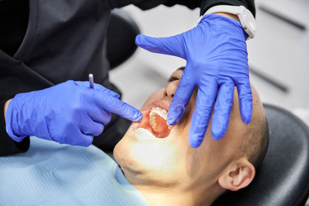 Best Emergency Broken Tooth Repair in Roan Mountain, TN