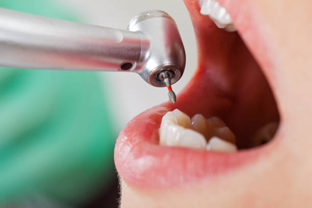 Best Weekend Emergency Dentist in Roan Mountain, TN